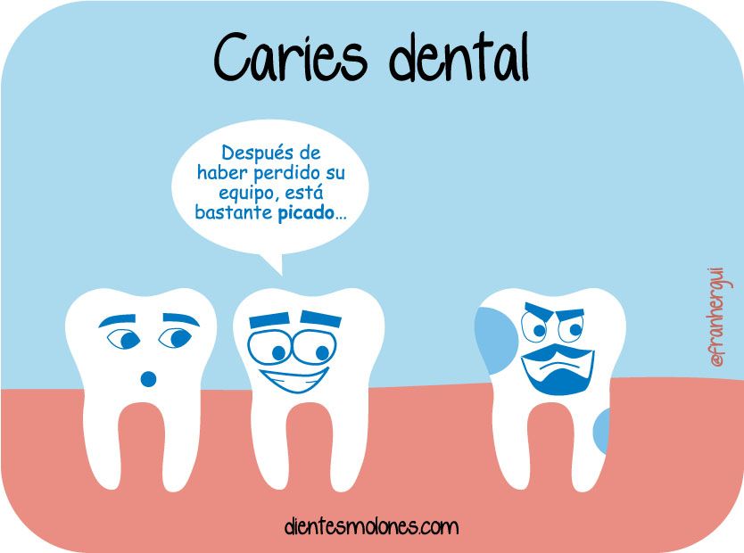 dientes-molones-caries3
